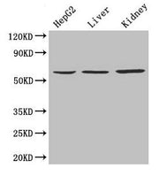 Western Blot Positive WB detected in: HepG2 whole cell lysate, Mouse liver tissue, Mouse kidney tissue All lanes: NAPRT antibody at 4µg/ml Secondary Goat polyclonal to rabbit IgG at 1/10000 dilution Predicted band size: 58, 61, 57 kDa Observed ban...