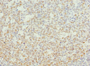 Immunohistochemistry of paraffin-embedded human tonsil tissue using CSB-PA015462DSR1HU at dilution of 1:100