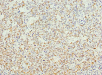 Immunohistochemistry of paraffin-embedded human tonsil tissue using CSB-PA015462DSR1HU at dilution of 1:100