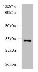 Western blot All lanes: NAT2 antibody at 6µg/ml + Mouse brain tissue Secondary Goat polyclonal to rabbit IgG at 1/10000 dilution Predicted band size: 34 kDa Observed band size: 34 kDa