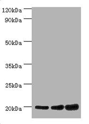 Western blot All lanes: NAA20 antibody at 10µg/ml Lane 1: Hela whole cell lysate Lane 2: Rat brain tissue Lane 3: 293T whole cell lysate Secondary Goat polyclonal to rabbit IgG at 1/10000 dilution Predicted band size: 21, 13 kDa Observed band size...