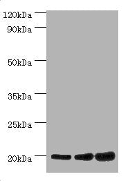 Western blot All lanes: NAA20 antibody at 10µg/ml Lane 1: Hela whole cell lysate Lane 2: Rat brain tissue Lane 3: 293T whole cell lysate Secondary Goat polyclonal to rabbit IgG at 1/10000 dilution Predicted band size: 21, 13 kDa Observed band size...