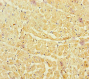 Immunohistochemistry of paraffin-embedded human heart tissue using CSB-PA015481ESR1HU at dilution of 1:100