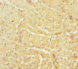 Immunohistochemistry of paraffin-embedded human heart tissue using CSB-PA015481ESR1HU at dilution of 1:100