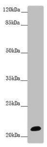 Western blot All lanes: NCALD antibody at 9.32 ug/ml + Mouse brain tissue Secondary Goat polyclonal to rabbit IgG at 1/10000 dilution Predicted band size: 22 kDa Observed band size: 22 kDa