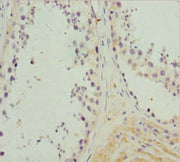 Immunohistochemistry of paraffin-embedded human testis tissue using CSB-PA015510DSR2HU at dilution of 1:100