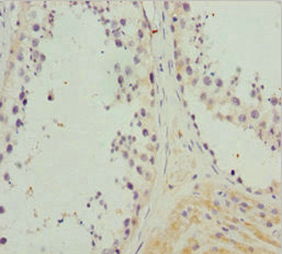 Immunohistochemistry of paraffin-embedded human testis tissue using CSB-PA015510DSR2HU at dilution of 1:100