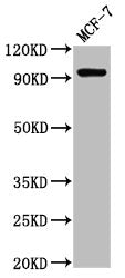 Western Blot Positive WB detected in: MCF-7 whole cell lysate All lanes: NCAM2 antibody at 2.7ug/ml Secondary Goat polyclonal to rabbit IgG at 1/50000 dilution Predicted band size: 94, 48 kDa Observed band size: 94 kDa