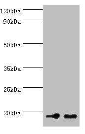 Western blot All lanes: NCBP2 antibody at 5µg/ml Lane 1: Hela whole cell lysate Lane 2: NIH/3T3 whole cell lysate Secondary Goat polyclonal to rabbit at 1/10000 dilution Predicted band size: 19, 16, 12 kDa Observed band size: 19 kDa