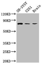 Western Blot Positive WB detected in: SH-SY5Y whole cell lysate, U251 whole cell lysate, Rat brain tissue All lanes: NCDN antibody at 2.6µg/ml Secondary Goat polyclonal to rabbit IgG at 1/50000 dilution Predicted band size: 79, 78, 80 kDa Observed...