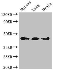 Western Blot Positive WB detected in: Mouse spleen tissue, Mouse lung tissue, Mouse brain tissue All lanes: NCF1 antibody at 3ug/ml Secondary Goat polyclonal to rabbit IgG at 1/50000 dilution Predicted band size: 45, 31 kDa Observed band size: 45 kDa