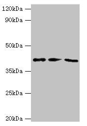 Western blot All lanes: NCK2 antibody at 10ug/ml Lane 1: Mouse spleen tissue Lane 2: Mouse brain tissue Lane 3: Mouse kidney tissue Secondary Goat polyclonal to rabbit IgG at 1/10000 dilution Predicted band size: 43 kDa Observed band size: 43 kDa