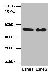 Western blot All lanes: NCK2 antibody at 8µg/ml Lane 1: Mouse brain tissue Lane 2: Mouse kidney tissue Secondary Goat polyclonal to rabbit IgG at 1/10000 dilution Predicted band size: 43 kDa Observed band size: 43 kDa