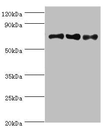Western blot All lanes: NCL antibody at 8ug/ml Lane 1: Jurkat whole cell lysate Lane 2: Hela whole cell lysate Lane 3: 293T whole cell lysate Secondary Goat polyclonal to rabbit IgG at 1/10000 dilution Predicted band size: 77 kDa Observed band siz...