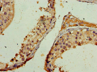 Immunohistochemistry of paraffin-embedded human testis tissue using CSB-PA015539HA01HU at dilution of 1:100