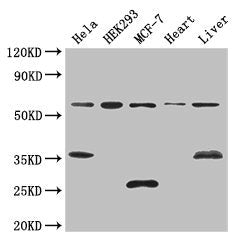 Western Blot Positive WB detected in: Hela whole cell lysate, HEK293 whole cell lysate, MCF-7 whole cell lysate, Mouse heart tissue, Mouse liver tissue All lanes: NCOA5 antibody at 3ug/ml Secondary Goat polyclonal to rabbit IgG at 1/50000 dilution...