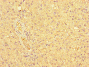 Immunohistochemistry of paraffin-embedded human adrenal gland tissue using CSB-PA015601LA01HU at dilution of 1:100