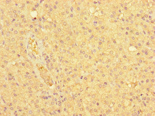 Immunohistochemistry of paraffin-embedded human adrenal gland tissue using CSB-PA015601LA01HU at dilution of 1:100
