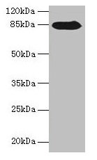 Western blot All lanes: NDST1 antibody at 6µg/ml + MCF-7 whole cell lysate Secondary Goat polyclonal to rabbit IgG at 1/10000 dilution Predicted band size: 101, 63 kDa Observed band size: 85 kDa