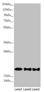Western blot All lanes: NDUFB10 antibody at 2.42µg/ml Lane 1: Mouse brain tissue Lane 2: HepG2 whole cell lysate Lane 3: 293T whole cell lysate Secondary Goat polyclonal to rabbit IgG at 1/10000 dilution Predicted band size: 21 kDa Observed band s...