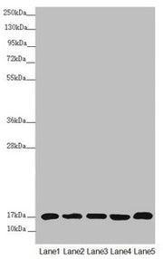 Western blot All lanes: NDUFB5 antibody at 2.64µg/ml Lane 1: Mouse heart tissue Lane 2: Mouse kidney tissue Lane 3: 293T whole cell lysate Lane 4: Jurkat whole cell lysate Lane 5: MCF-7 whole cell lysate Secondary Goat polyclonal to rabbit IgG at...