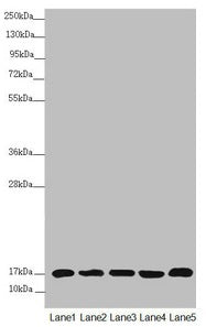 Western blot All lanes: NDUFB5 antibody at 2.64µg/ml Lane 1: Mouse heart tissue Lane 2: Mouse kidney tissue Lane 3: 293T whole cell lysate Lane 4: Jurkat whole cell lysate Lane 5: MCF-7 whole cell lysate Secondary Goat polyclonal to rabbit IgG at...