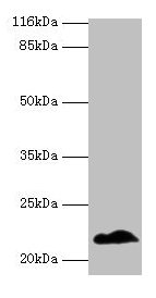 Western blot All lanes: NDUFB5 antibody at 2µg/ml + U251 whole cell lysate Secondary Goat polyclonal to rabbit IgG at 1/10000 dilution Predicted band size: 22, 16 kDa Observed band size: 22 kDa