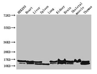 Western Blot Positive WB detected in: HEK293 whole cell lysate, Mouse heart tissue, Mouse liver tissue, Mouse spleen tissue, Mouse lung tissue, Mouse kidney tissue, Mouse brain tissue, Mouse skeletal muscle tissue, Mouse thymus tissue All lanes: N...