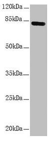 Western blot All lanes: NDUFS1 antibody at 1.15µg/ml + HepG2 whole cell lysate Secondary Goat polyclonal to rabbit IgG at 1/10000 dilution Predicted band size: 80, 81, 68, 74, 76 kDa Observed band size: 80 kDa