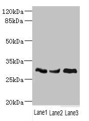 Western blot All lanes: NDUFS3 antibody at 1.98ug/ml Lane 1: Mouse brain tissue Lane 2: Mouse skeletal muscle tissue Lane 3: Mouse heart tissue Secondary Goat polyclonal to rabbit IgG at 1/10000 dilution Predicted band size: 31, 15 kDa Observed ba...