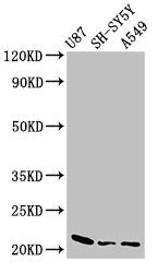 Western Blot Positive WB detected in: U87 whole cell lysate, SH-SY5Y whole cell lysate, A549 whole cell lysate All lanes: NDUFS4 antibody at 2.5µg/ml Secondary Goat polyclonal to rabbit IgG at 1/50000 dilution Predicted band size: 21 kDa Observed...