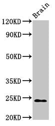 Western Blot Positive WB detected in: Rat brain tissue All lanes: NDUFS8 antibody at 2.7ug/ml Secondary Goat polyclonal to rabbit IgG at 1/50000 dilution Predicted band size: 24 kDa Observed band size: 24 kDa