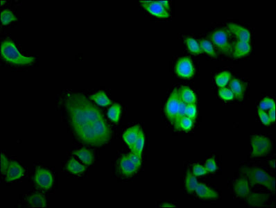 Immunofluorescence staining of PC-3 cells with CSB-PA015673LA01HU at 1:133, counter-stained with DAPI. The cells were fixed in 4% formaldehyde, permeabilized using 0.2% Triton X-100 and blocked in 10% normal Goat Serum. The cells were then incubat...