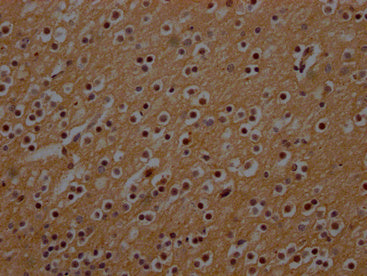 IHC image of CSB-PA015686LA01HU diluted at 1:300 and staining in paraffin-embedded human brain tissue performed on a Leica BondTM system. After dewaxing and hydration, antigen retrieval was mediated by high pressure in a citrate buffer (pH 6.0). S...