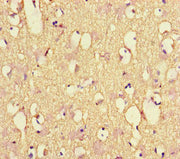Immunohistochemistry of paraffin-embedded human brain tissue using CSB-PA015688LA01HU at dilution of 1:100