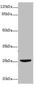 Western blot All lanes: NEGR1 antibody at 4µg/ml + U87 whole cell lysate Secondary Goat polyclonal to rabbit IgG at 1/10000 dilution Predicted band size: 39, 25 kDa Observed band size: 25 kDa