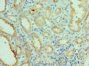 Immunohistochemistry of paraffin-embedded human kidney tissue using CSB-PA015699ESR1HU at dilution of 1:100