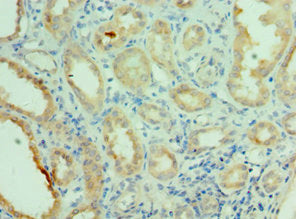 Immunohistochemistry of paraffin-embedded human kidney tissue using CSB-PA015699ESR1HU at dilution of 1:100