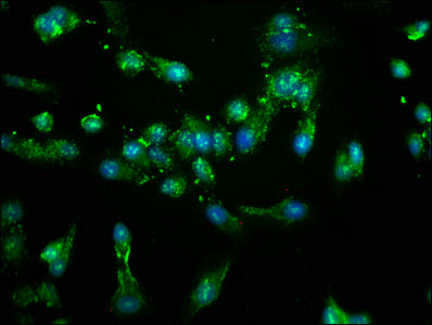 Immunofluorescence staining of Hela cells with CSB-PA015702LA01HU at 1:100, counter-stained with DAPI. The cells were fixed in 4% formaldehyde, permeabilized using 0.2% Triton X-100 and blocked in 10% normal Goat Serum. The cells were then incubat...
