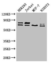 Western Blot Positive WB detected in: HEK293 whole cell lysate, Jurkat whole cell lysate, MCF-7 whole cell lysate, NIH/3T3 whole cell lysate All lanes: NF2 antibody at 2.6ug/ml Secondary Goat polyclonal to rabbit IgG at 1/50000 dilution Predicted...