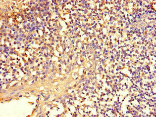 Immunohistochemistry of paraffin-embedded human tonsil tissue using CSB-PA015751LA01HU at dilution of 1:100