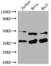 Western Blot Positive WB detected in: Jurkat whole cell lysate, Hela whole cell lysate, Raji whole cell lysate All lanes: NFKBIA antibody at 1:2000 Secondary Goat polyclonal to rabbit IgG at 1/50000 dilution Predicted band size: 36 kDa Observed ba...