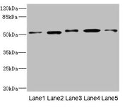 Western blot All lanes: NFKBIE antibody at 4.17ug/ml Lane 1: Mouse liver tissue Lane 2: Hela whole cell lysate Lane 3: Jurkat whole cell lysate Lane 4: A375 whole cell lysate Lane 5: 293T whole cell lysate Secondary Goat polyclonal to rabbit IgG a...