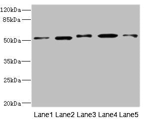 Western blot All lanes: NFKBIE antibody at 4.17ug/ml Lane 1: Mouse liver tissue Lane 2: Hela whole cell lysate Lane 3: Jurkat whole cell lysate Lane 4: A375 whole cell lysate Lane 5: 293T whole cell lysate Secondary Goat polyclonal to rabbit IgG a...