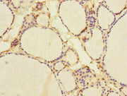 Immunohistochemistry of paraffin-embedded human thyroid tissue using CSB-PA015764ESR2HU at dilution of 1:100