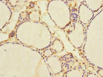 Immunohistochemistry of paraffin-embedded human thyroid tissue using CSB-PA015764ESR2HU at dilution of 1:100