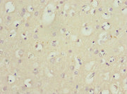 Immunohistochemistry of paraffin-embedded human brain tissue using CSB-PA015781ESR1HU at dilution of 1:100