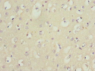 Immunohistochemistry of paraffin-embedded human brain tissue using CSB-PA015781ESR1HU at dilution of 1:100