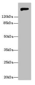 Western blot All lanes: Nid1 antibody at 6µg/ml + Rat lung tissue Secondary Goat polyclonal to rabbit IgG at 1/10000 dilution Predicted band size: 137 kDa Observed band size: 150 kDa