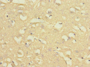 Immunohistochemistry of paraffin-embedded human brain tissue using CSB-PA015821DSR1HU at dilution of 1:100